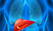 Estudio revela cómo el hígado graso favorece la propagación del cáncer colorrectal